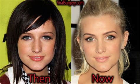 Ashlee Simpson Plastic Surgery Before And After Nose Job Pictures