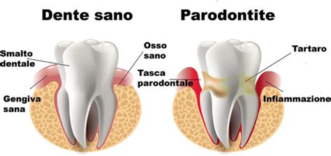Parodontologo Salute Delle Gengive E Dei Denti Centro
