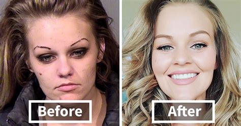 Drug Addicts Before And After
