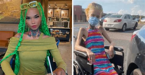Ig Model Gena Tew Announces She S Blind Again After Failed Eye Surgery After Being Diagnosed