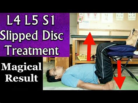 Management of slipped discs depends on many factors like age, symptoms, job profile of a person, time since the problem arises, the lifestyle of person, and many more. L4 L5 S1 SLIPPED DISC EXERCISES - Amazing Technique For L4 ...