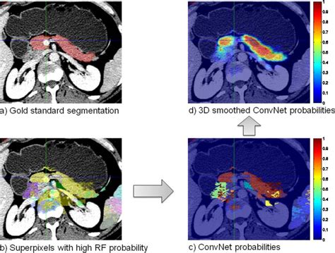 Deep Convolutional Networks For Pancreas Segmentation In Ct Imaging