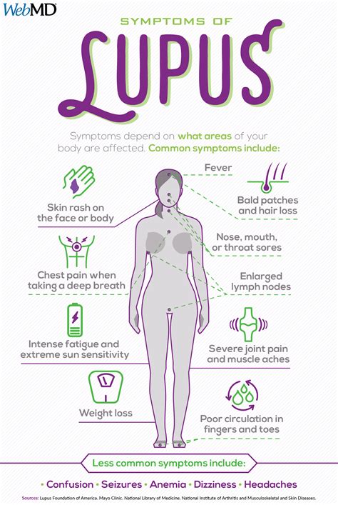 A Visual Guide To Lupus Lupus Facts Medical Knowledge Lupus