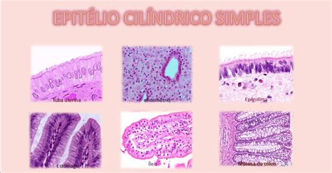 Histologia Embriologia para Fisioterapia Epitélio Cilíndrico Simples
