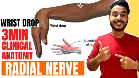 Wrist Drop Anatomy Radial Nerve Clinical Anatomy Clinical Anatomy Of