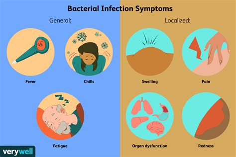 Una Descripción General De Las Infecciones Bacterianas Medicina Básica
