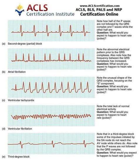 Ekg Practice Strips Printable Users Are Asked To Identify The