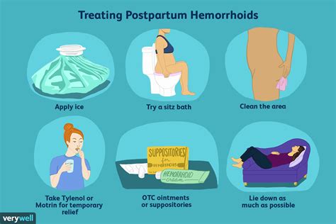 Top How To Soothe Hemorrhoids After Birth