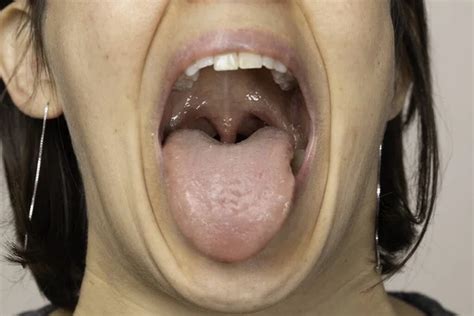 Throat Examination Images Search Images On Everypixel