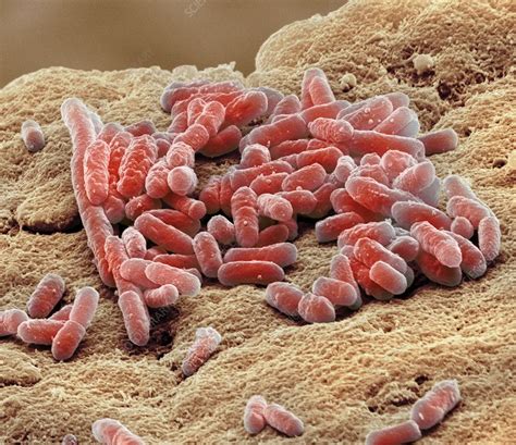 Lactobacillus Bacteria Sem Stock Image C0207281 Science Photo