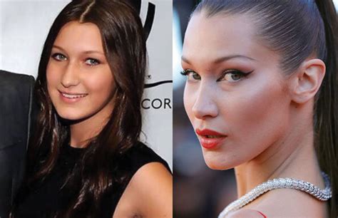 Bella hadid at the 2010 grand slam for children benefit concert. Bella Hadid Surgery: How Fashion Industry Promotes Body ...