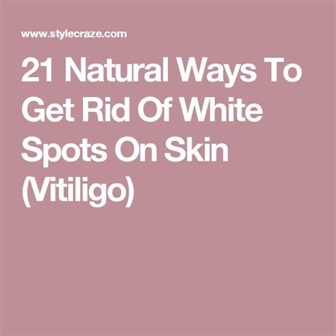 21 Natural Ways To Get Rid Of White Spots On Skin Vitiligo Vitiligo