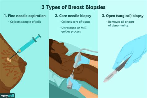 Breast Biopsy Procedure Uses Side Effects Results