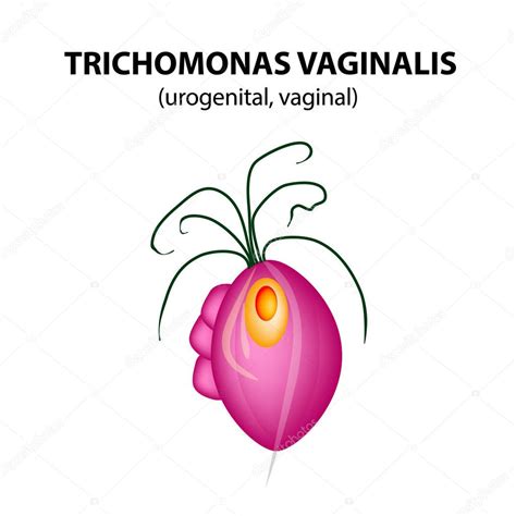 Trichomonas Vaginalis Estructura Tricomoniasis Infección Urogenital