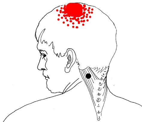 Common And Rare Diseases In Head And Neck