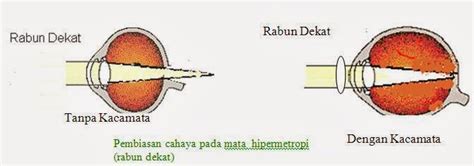 Rumus Rabun Dekat Lembar Edu