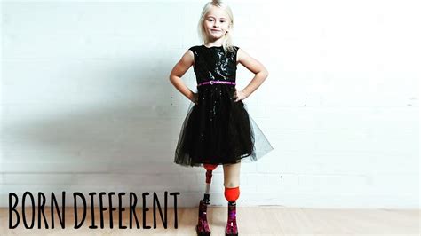 The Little Girl With No Legs And Big Dreams Born Different Gentnews