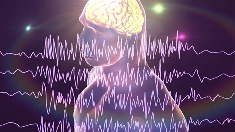 Epilepsie Neue Ansätze Bei Therapie Und Hilfen Im Alltag Swr Wissen