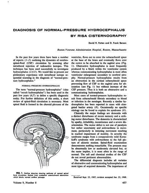 Diagnosis Of Normal Pressure Hydrocephalus By Risa Cisternography Journal Of Nuclear Medicine