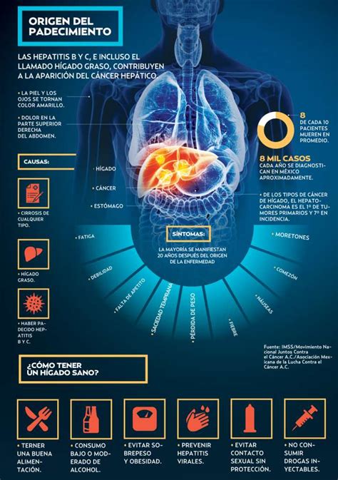 Aumentan Casos De Cáncer De Hígado En México El Heraldo De México