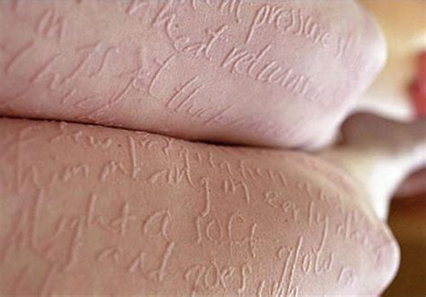 Use My Skin Condition Dermographism To Write Anything You Want On It