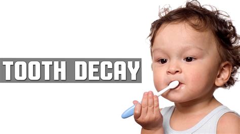 Can toddlers have tooth decay? DIY: Best Cure For Kids Tooth Decay with Natural Home ...