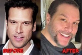 Dane Cook Plastic Surgery - Before and After Photos - Celebrity Plastic ...