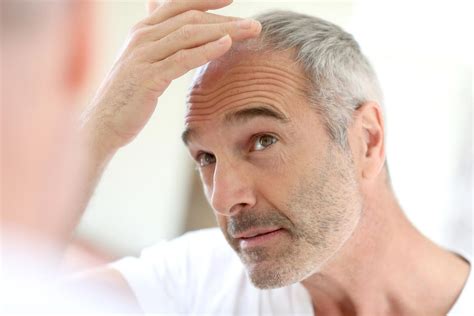 Those who experience thinning hair because of male pattern baldness are not necessarily doomed to lose all of their hair. What Is Common Male Balding? | ThinningHair.com