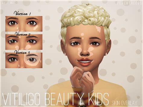 The Sims Resource Vitiligo Beauty Skin Overlay Kids N3