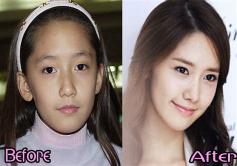 In 2001, kim tae hee started her career trajectory in the movie industry. Yoona SNSD Plastic Surgery Before After Photos ...