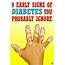 9 Early Signs Of Diabetes We Probably Ignore  Health Page