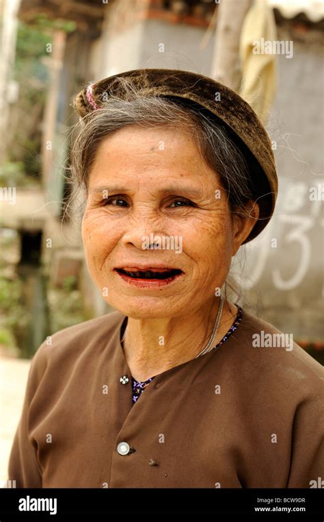 Old Vietnamese Woman With Black Teeth From Chewing Betel Nut Vinh Phuc Province Vietnam Stock