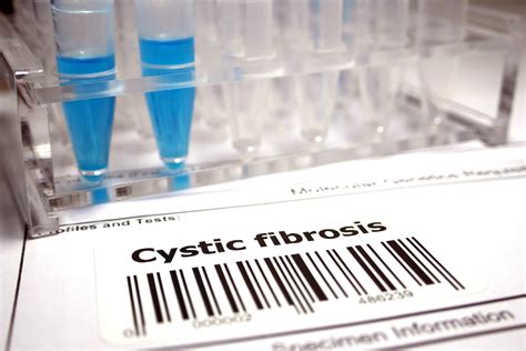 Cystic Fibrosis Testing Rare Disease Advisor