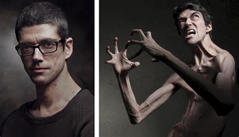 This Is Javier Botet A Spanish Almost 69” Actor Who Has A Genetic