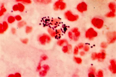 Gram Staining For Bacteria Stainsfile