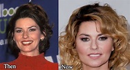 Shania Twain Plastic Surgery Before and After Photos - Latest Plastic ...