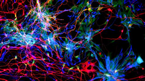 Trio Of Genes Supercharged Human Brain Evolution Science Aaas