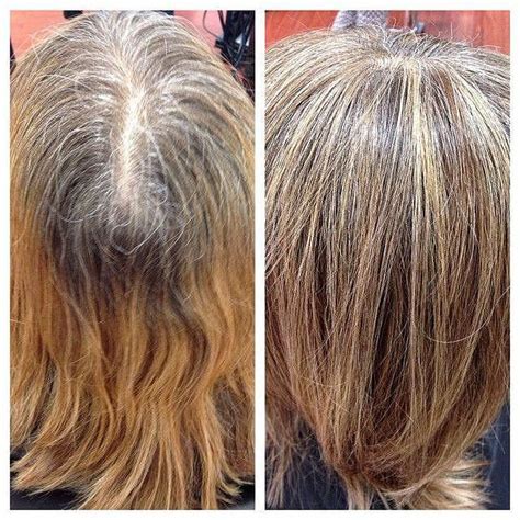 Best Highlights To Blend Gray Hair Image Results Blending