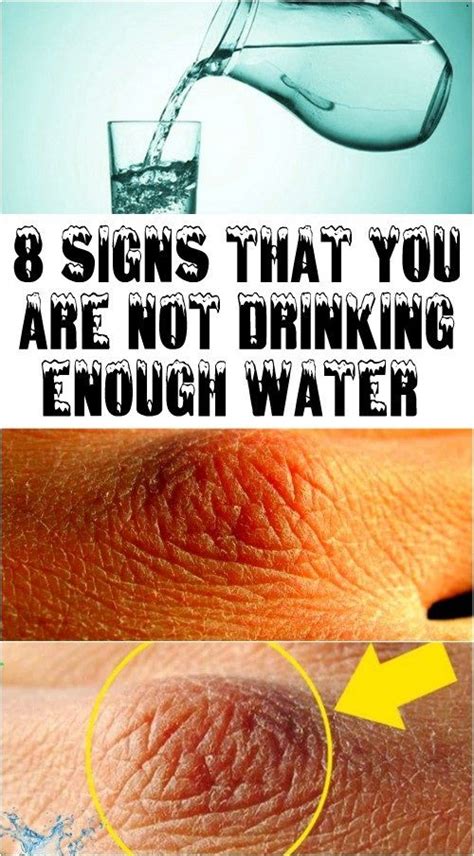 8 Signs That You Are Not Drinking Enough Water Secret Of