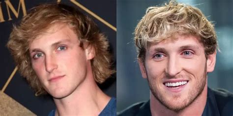 Whats Wrong With Logan Pauls Hairline Hair System