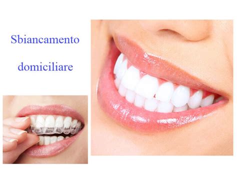 Sbiancamento Denti Professionale Come Funziona I Costi Dentista Resta