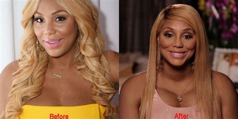 Tamar Braxton Plastic Surgery Before And After Pictures