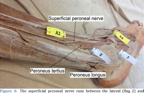 Figure 5 From The Superficial Peroneal Nerve A Review Of Its Anatomy