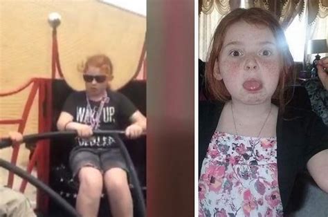A Girls Scalp Was Torn Off After Her Hair Got Caught In A Carnival Ride