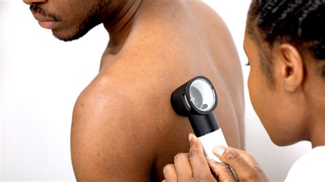 How Do You Detect Skin Cancer How Much Does Screening Cost GoodRx
