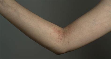 7 Causes Of Skin Rashes You Might Not Know About Read