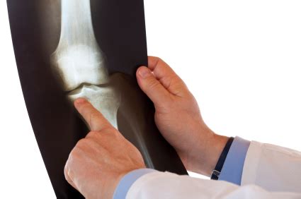 Let us help you find a doctor. Sports Medicine Specialists, Brampton :: Orthopaedic Surgeons