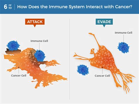 What Is Cancer Hoa Hematology Oncology Associates Of Cny