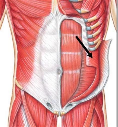 A hernia will usually cause a distinct bulge where the tissue or organ pushes through the muscle wall. A&P Lab Muscles of the head,neck&trunk at Pima Medical ...