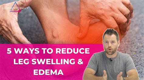 Reduce Leg Swelling Edema 5 Key Remedies To Rebalance Your Fluids